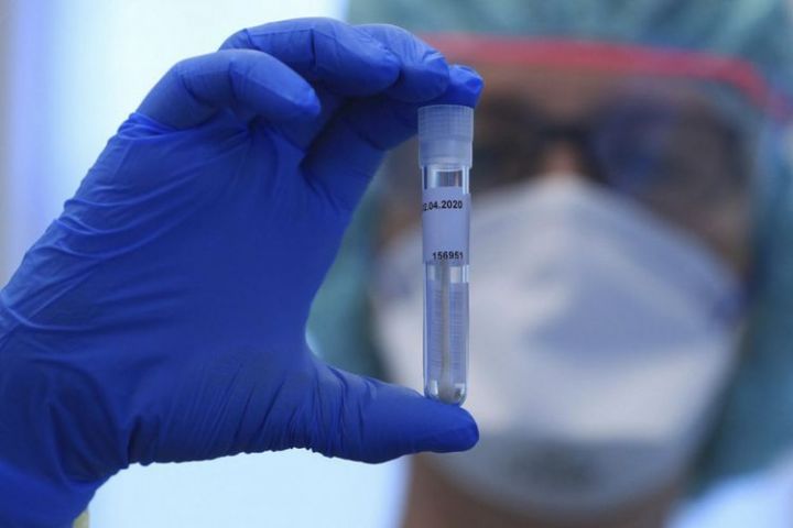 Azərbaycanda koronavirus ilə bağlı son vəziyyət açıqlandı