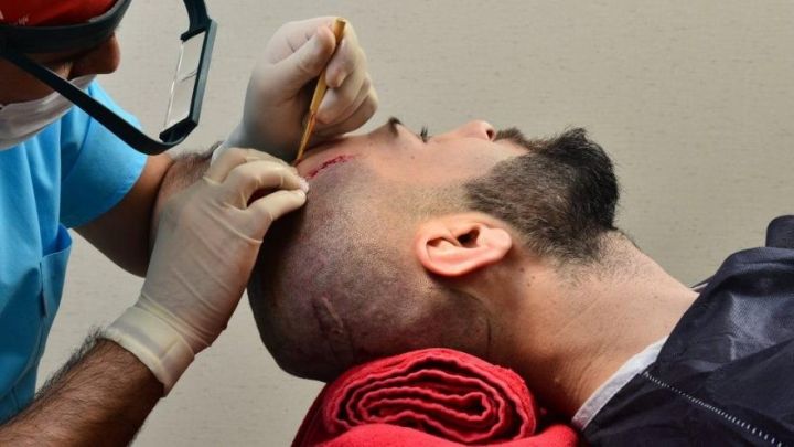 Saç əkilməsində birincidir, 1,5 milyard dollar gəlir əldə edib