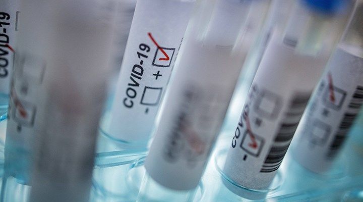 Azərbaycanda koronavirus ilə bağlı son vəziyyət açıqlandı