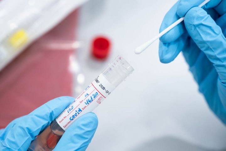 Azərbaycanda koronavirus ilə bağlı son vəziyyət açıqlandı