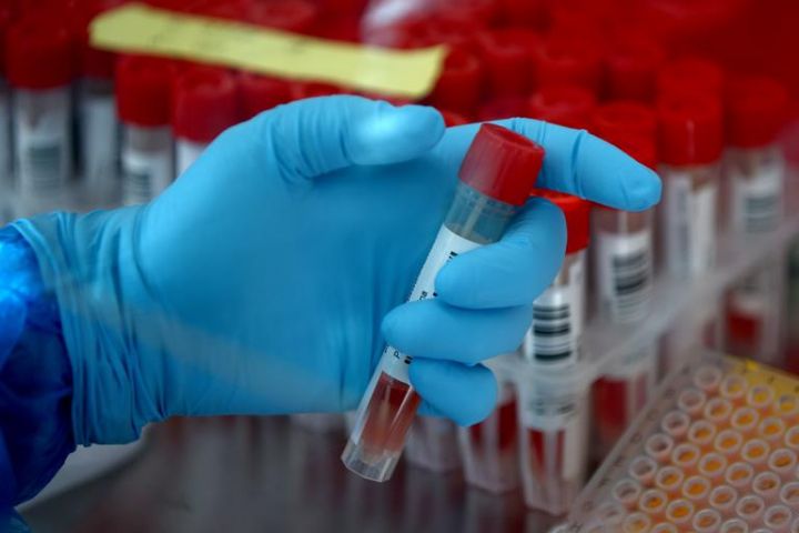 Azərbaycanda koronavirus ilə bağlı son vəziyyət açıqlandı