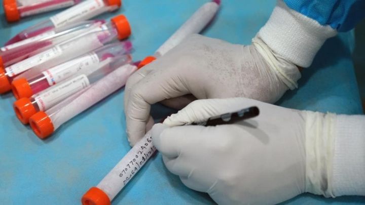 Azərbaycanda koronavirus ilə bağlı son vəziyyət açıqlandı